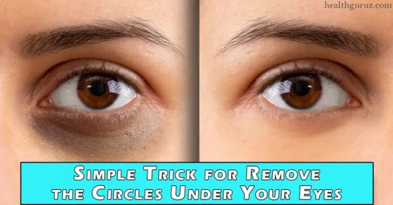 Simple Trick for Remove the Circles Under Your Eyes
